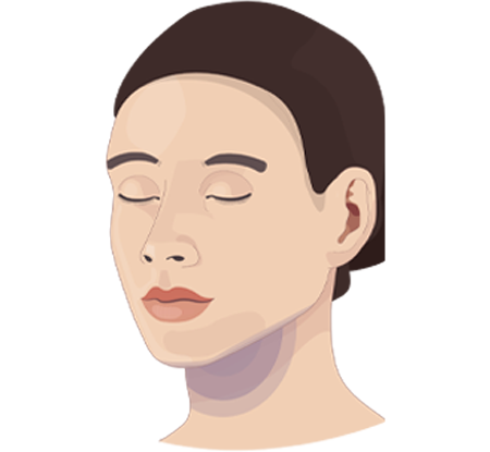 Liposuction Areas-Face